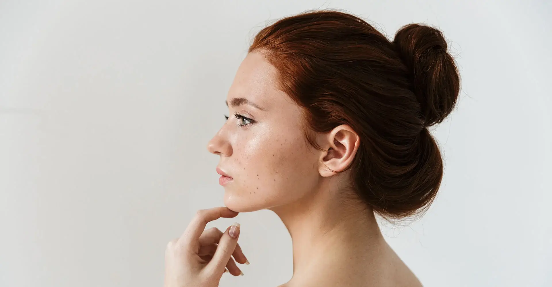 Dott.ssa Virginia De Simone - Medicina estetica. Bellissima ragazza, con i capelli rossi raccolti e occhi chiari, di profilo con una mano sotto il mento